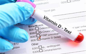 25-羥基維生素D-磁微?；瘜W(xué)發(fā)光法（AE/AP） /熒光免疫層析解決方案（雙抗體夾心法）