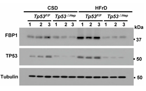 《Nature》脂肪肝為什么會導致肝癌？