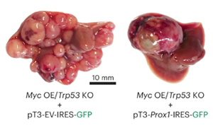 《Nature Genetics》PROX1積極抑制細(xì)胞命運(yùn)可塑性，保護(hù)肝細(xì)胞身份，防止肝腫瘤發(fā)生