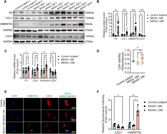MDA5陽性皮肌炎患者血清可誘導原代小鼠肺微血管內皮細胞發(fā)生內皮-間質轉化