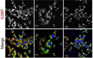 《Nature》細(xì)胞的應(yīng)激反應(yīng)比科學(xué)家認(rèn)為的更細(xì)微、更分散