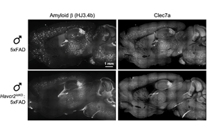 Nature：在大腦免疫細(xì)胞中發(fā)現(xiàn)潛在的阿爾茨海默病治療靶點(diǎn)