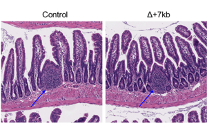 Nature：科學(xué)家新發(fā)現(xiàn)一種免疫細(xì)胞類(lèi)型，與過(guò)敏有關(guān)