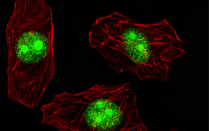 細胞表面的RNA結(jié)合蛋白是對抗癌癥的關(guān)鍵