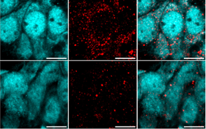 重大發(fā)現(xiàn)！阿爾茨海默病患者來源的高分子量 tau 蛋白如何 “破壞” 海馬神經(jīng)元？
