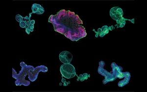 藥物研發(fā)的未來——類器官技術