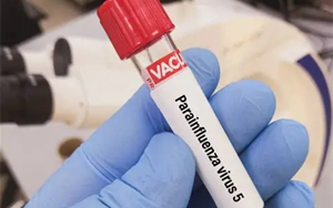 副流感病毒（HPIV1、2、3型）抗原檢測(cè)-免疫層析 （膠體金、彩色乳膠及熒光免疫層析）解決方案