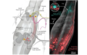 揭示自主神經(jīng)反射異常（AD）的神經(jīng)元架構：脊髓損傷后惡性高血壓發(fā)作的機制與神經(jīng)調(diào)控治療新策略
