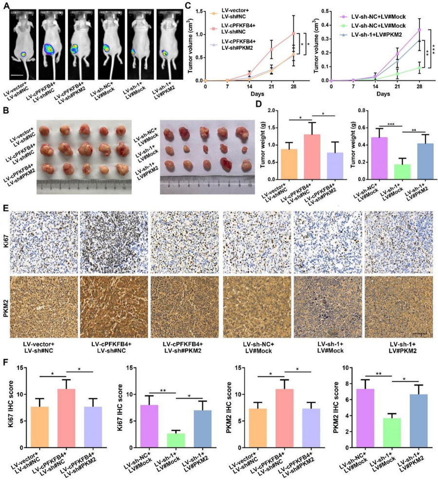 cPFKFB4通過(guò)PKM2促進(jìn)胰腺癌惡性進(jìn)展