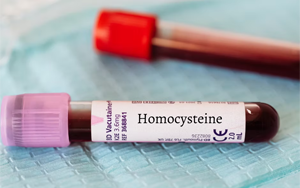 同型半胱氨酸（HCY）-磁微?；瘜W發(fā)光法（AE/AP） +熒光免疫層析解決方案