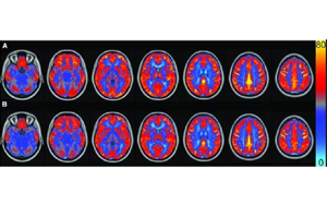 AJCN：要長(zhǎng)壽，常吃豆！長(zhǎng)期食用大豆飲食可讓大腦“更靈光”