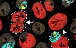 Nature 三連重磅！識破癌細胞的“詭計”，為結(jié)直腸癌患者帶來新希望