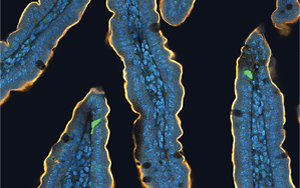 喝完無糖飲料還想吃甜食？人們對糖的渴望，無法被甜味劑替代，答案都在腸道里！