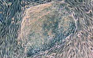 首次發(fā)現(xiàn)人類尿液來源的干細(xì)胞具有強(qiáng)大的再生潛力！