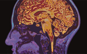 新冠帶來(lái)又一挑戰(zhàn)！下一步可能是“癡呆癥浪潮”