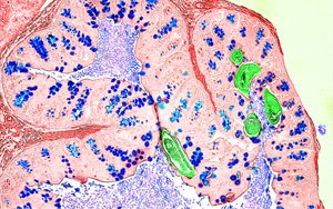 Nature新研究解答爭(zhēng)議，為炎癥性疾病的免疫機(jī)制提供新見(jiàn)解