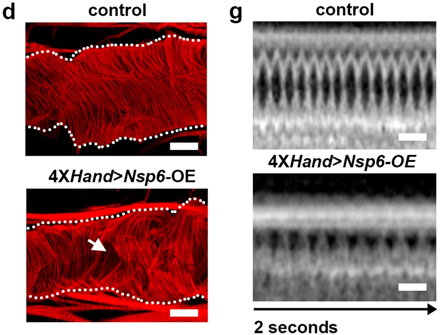 UAS-SARS-CoV-2Nsp6轉(zhuǎn)基因的4XH和Gal4、成纖維細胞特異性過表達（OE）誘導的成人心臟表型