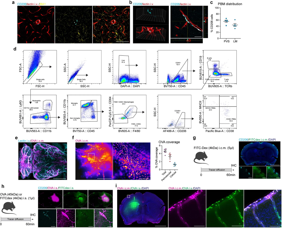 PBMs不同于小膠質細胞和CSF和ISF樣本