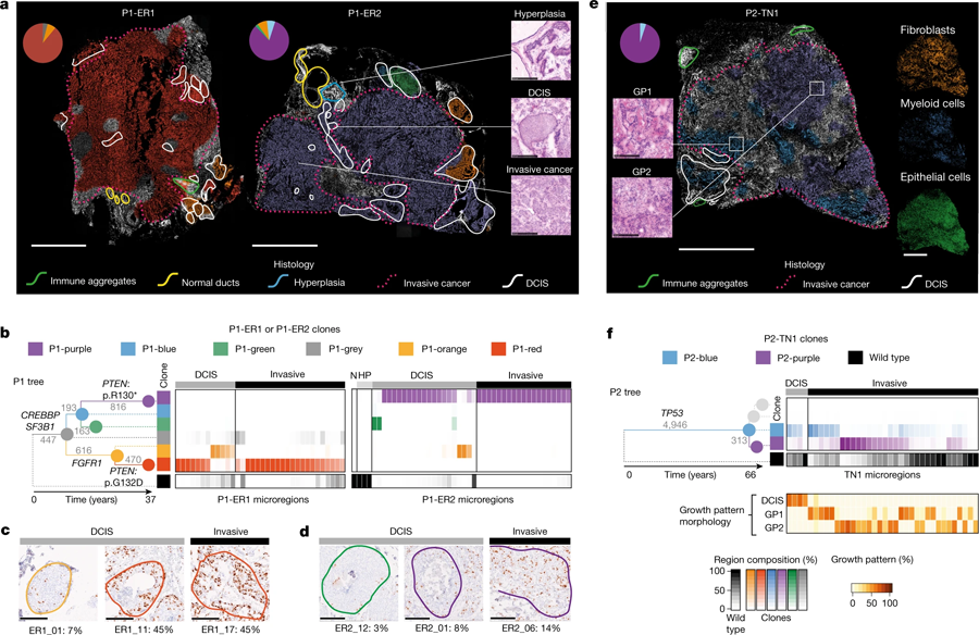由三位原發(fā)性乳腺癌患者的組織學(xué)檢測繪制的遺傳克隆圖 由三位原發(fā)性乳腺癌患者的組織學(xué)檢測繪制的遺傳克隆圖