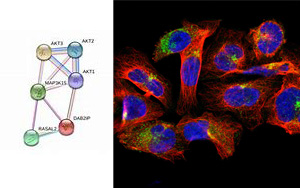 Science Advances：外顯子組測(cè)序研究發(fā)現(xiàn)糖尿病的潛在治療靶點(diǎn)