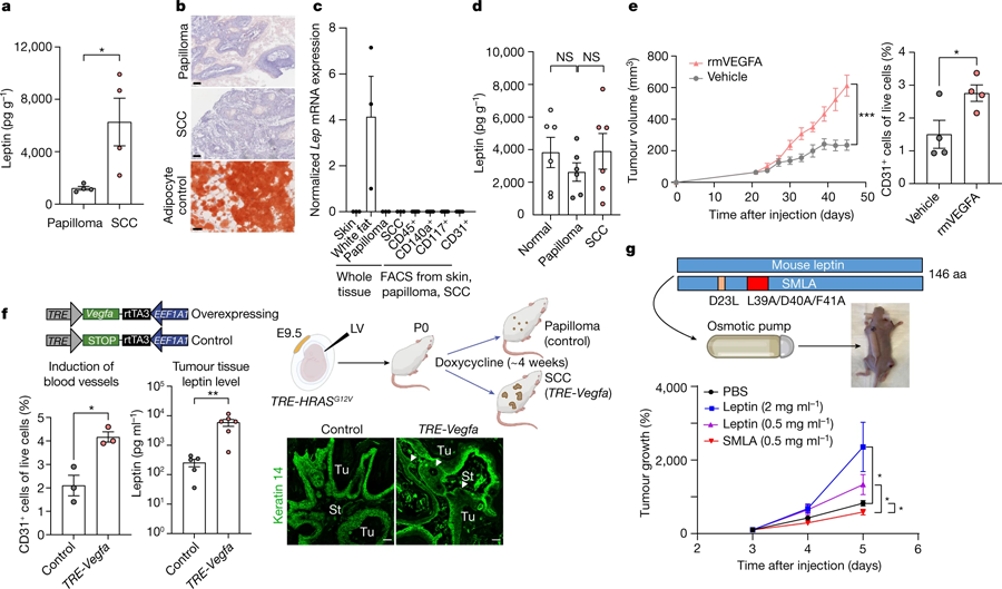 惡性腫瘤微環(huán)境中瘦素水平升高，是由血管生成增加引起的