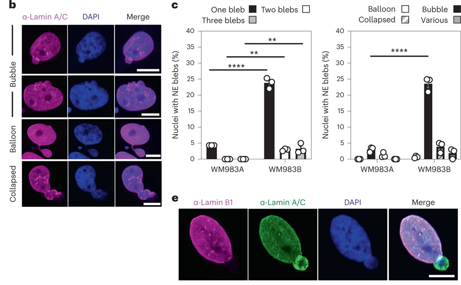 轉(zhuǎn)移性黑色素瘤細(xì)胞的NE(核包膜蛋白)是高度活躍的 轉(zhuǎn)移性黑色素瘤細(xì)胞的NE(核包膜蛋白)是高度活躍的