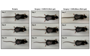 CAR-T細(xì)胞療法再獲突破！有效清除術(shù)后殘留癌細(xì)胞、預(yù)防腫瘤復(fù)發(fā)，即將開展臨床試驗(yàn)