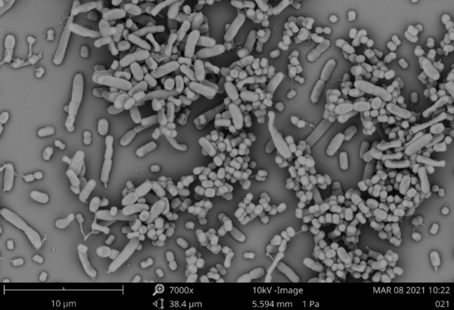 掃描電鏡顯示肺炎克雷伯菌和鮑曼不動(dòng)桿菌在生物膜中共同生長(zhǎng)
