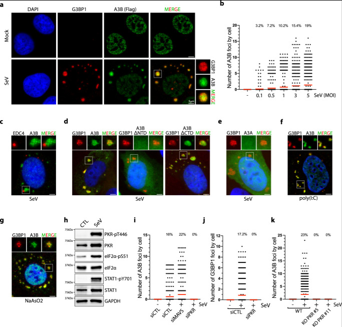 SeV感染誘導APOBEC3B定位于應(yīng)激顆粒 SeV感染誘導APOBEC3B定位于應(yīng)激顆粒