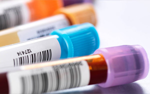 前白蛋白（PAB）檢測試劑盒原輔料