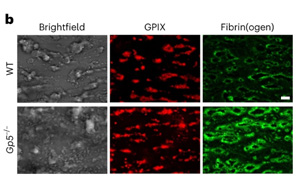 Nature子刊發(fā)現(xiàn)全新機(jī)制：新的凝血調(diào)節(jié)機(jī)制