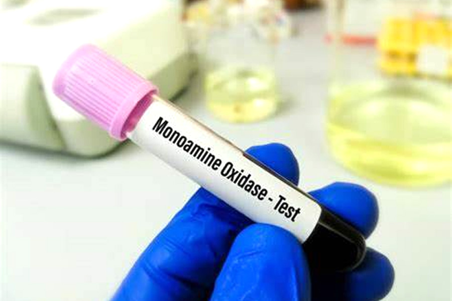 單胺氧化酶(MAO)檢測(cè) 單胺氧化酶(MAO)檢測(cè)