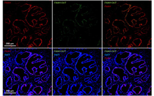 一種罕見基因突變，感覺不到疼痛！新研究揭示其獨特的分子機制