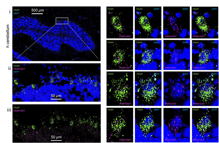FAAH和FAAH-OUT RNA在人腦組織細(xì)胞中的表達(dá)水平和定位 FAAH和FAAH-OUT RNA在人腦組織細(xì)胞中的表達(dá)水平和定位