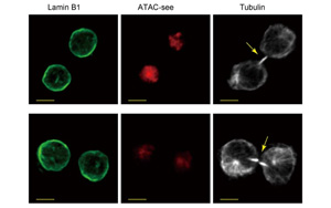 是什么決定了CD8+ T細(xì)胞的命運(yùn)？Immunity新研究指向cBAF復(fù)合物
