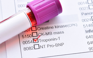心肌肌鈣蛋白T（cTnT）-磁微?；瘜W(xué)發(fā)光法（吖啶酯） /熒光免疫層析解決方案