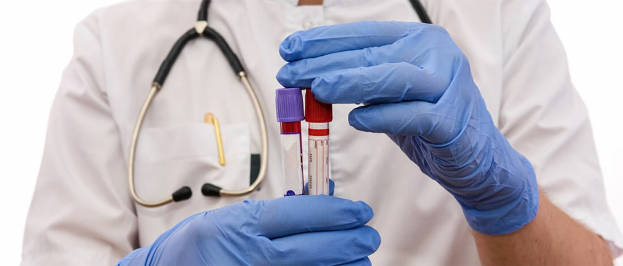 肌酸激酶MB檢測