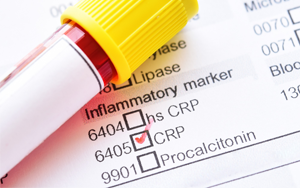C-反應(yīng)蛋白（CRP）-熒光免疫層析解決方案