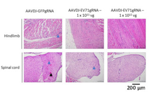 新加坡科學(xué)家開發(fā)基因編輯技術(shù)，消除EV-A71 RNA病毒