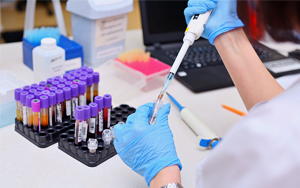 可溶性生長刺激表達基因2蛋白（ST2）- 磁微粒化學(xué)發(fā)光法（吖啶酯）/熒光免疫層析解決方案