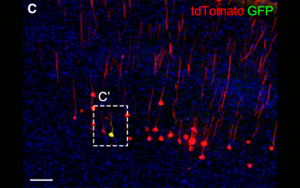 《Neuron》科學(xué)家發(fā)現(xiàn)腦力更新的生物標(biāo)志物