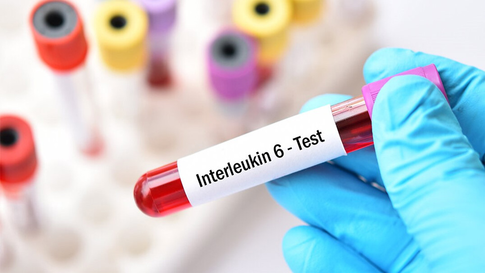 IL-6磁微?；瘜W發(fā)光熒光免疫層析