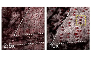 Nature新研究解釋了為什么癌基因突變的細(xì)胞可以在正常的人體組織中存在