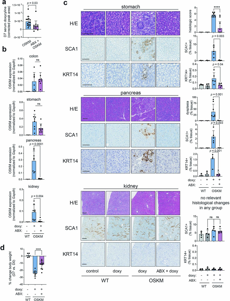廣譜抗生素治療抑制體內(nèi)重編程 廣譜抗生素治療抑制體內(nèi)重編程