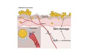 Cell：首次證明一種常見的皮膚細(xì)菌可以通過(guò)直接作用于神經(jīng)細(xì)胞而引起瘙癢