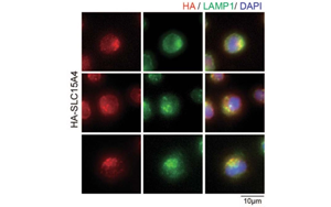 Nature子刊：開創(chuàng)性的將化學(xué)探針引入活細(xì)胞，靶向紅斑狼瘡