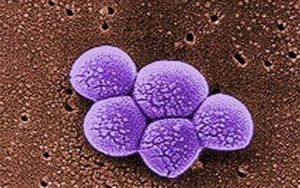 《Science》突破性新抗生素，遏制耐藥細菌