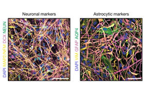 Nature發(fā)現(xiàn)破解神經(jīng)退行性疾病的密碼