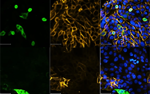 Nature最新研究表明，一類新的抗病毒藥物可以對抗SARS-CoV-2