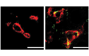 Nature子刊：肝臟中的免疫細胞會對高膽固醇水平做出反應，并吃掉多余的膽固醇